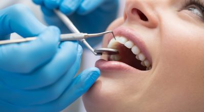 Dental Treatments FAQ