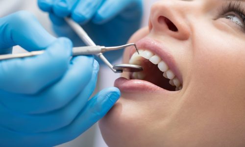 Dental Treatments FAQ
